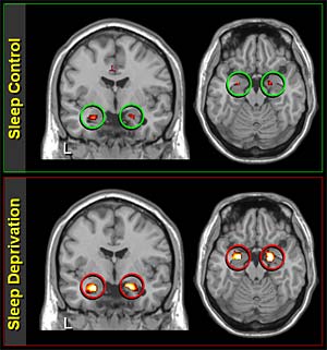 brain after sleep deprivation image 1 2ndskiesforex