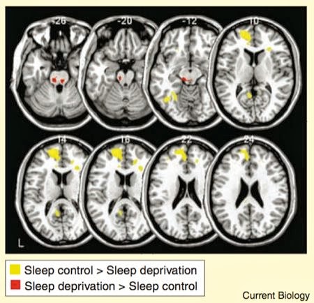 brain after sleep deprivation image 2 2ndskiesforex